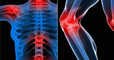 Nëse vuani nga reumatizma, duhet të konsumoni vazhdimisht këto ushqime