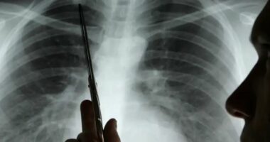 Diskriminimi ndaj grave rrit rrezikun e kancerit