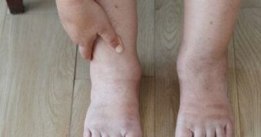 Keni telashe me ënjtjen e këmbëve, ky lëng ju ndihmon