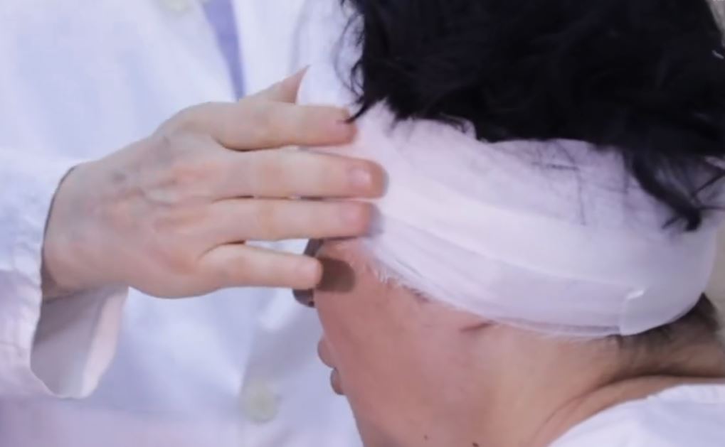 VIDEO/ Realizohet për herë të parë në QSUT heqja e plotë e tumorit të kokës përmes syrit