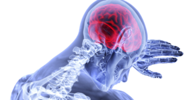 Vdekjet nga goditjet në tru mund të dyfishohen deri në vitin 2050, paralajmërojnë shkencëtarët