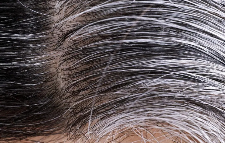 Thinja e parakohshme e flokëve, disa prej faktorëve që ndikojnë