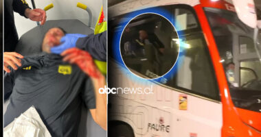 FOTO/ Tensione para sfidës Marseille-Lyon, ultrasit vendas gjakosin trajnerin Fabio Grosso