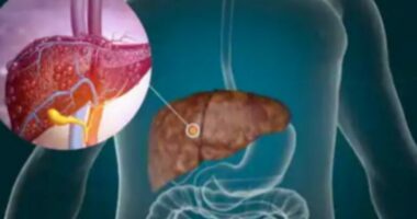 Studim/ Njihuni me ushqimin që ul yndyrën e mëlçisë me 40%