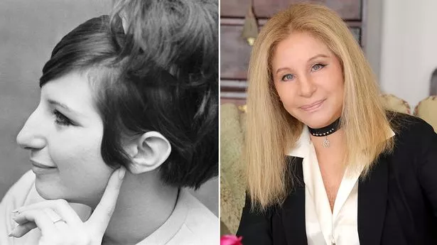 Barbra Streisand tregon arsyen pse nuk bëri kurrë një ndërhyrje estetike në hundë