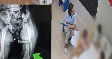 EMRAT/ Dhuna ndaj 3-vjeçares në Tiranë, pezullohen tre zyrtarë të policisë