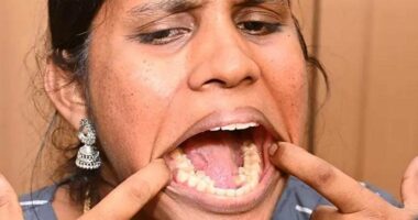 Gruaja indiane me 38 dhëmbë fiton Rekordin Botëror Guinness