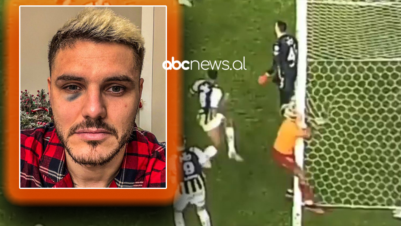 VIDEO/ Icardi goditi shtyllën me fytyrë dhe u pretendua për penallti, “luftë” në rrjetet sociale mes Fenerbahce dhe Galatasaray