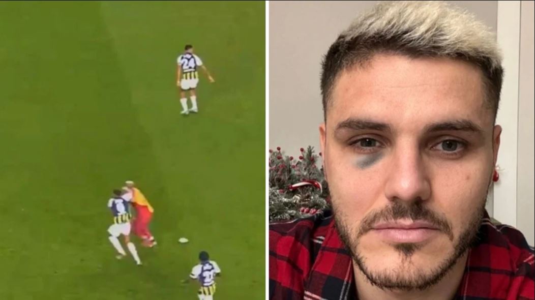 VIDEO/ Fenerbahce pretendoi se Icardi nxiu syrin pasi u përplas me shtyllën, dalin pamjet kur kundërshtari godet me grusht argjentinasin