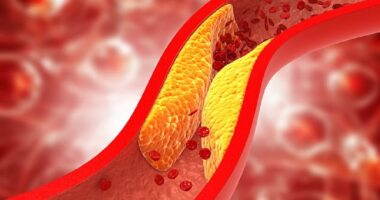 ​Zbulohet vaksina “premtuese” për uljen e kolesterolit