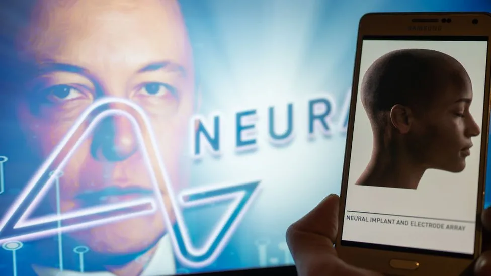 Kompania e Elon Musk, Neuralink implanton çipin e parë në trurin e njeriut