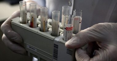 Përhapet hepatiti A në zonat e mbipopulluara në Gaza