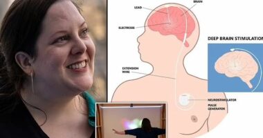 Elektroda në tru kundër depresionit, mbi 20 vite studime sjellin rezultatet e para