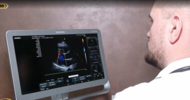 Problemet kardiake edhe tek të rinjtë, mjekët: Ndikojnë stili i keq i jetesës dhe stresi