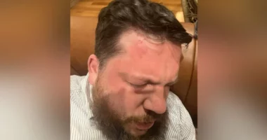 Krahu i djathtë i Alexei Navalny sulmohet me çekiç në Lituani