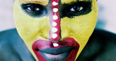 UNICEF: Më shumë se 230 milionë gra dhe vajza i janë nënshtruar gjymtimit gjenital