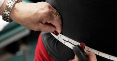 Mbi një miliard njerëz përballen me obezitet në botë