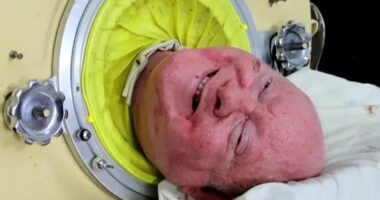 U prek nga poliomeliti në moshën 6-vjeçare, ndërron jetë njeriu që jetoi për 70 vite në një “mushkri hekuri”