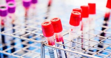 Shkencëtarët: Tashmë mund ta ‘zhdukim’ HIV-in nga qelizat, falë teknologjisë së modifikimit të gjeneve