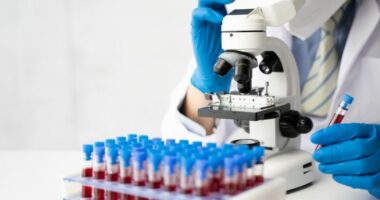 83% i saktë, kanceri i zorrës së trashë mund të zbulohet vetëm me një test gjaku