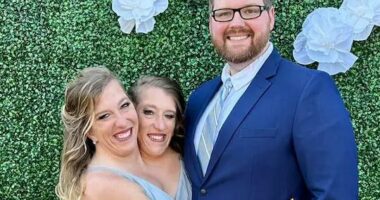 VIDEO/ Historia e motrave siameze që ndajnë të njëjtin trup, martohet njëra prej tyre