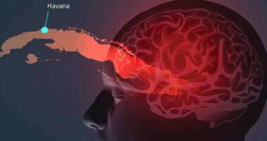 “Sindroma e Havanës”/ Raporti: Rusia përdori armë sekrete me energji të lartë kundër agjentëve të FBI, CIA dhe zyrtarëve amerikanë