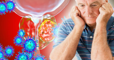 Numri i të sëmurëve nga kanceri i prostatës në botë po rritet