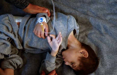 Në Gaza, të gjithë po vuajnë nga uria/ Ekspertët: Rritet numri i fëmijëve që po vdesin nga kequshqyerja