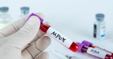 Lija e majmunit/ Shkencëtarët: Virusi po ndryshon më shpejt seç pritej