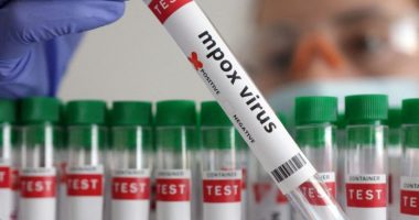 Situatë shqetësuese në Afrikë, virusi i lisë së majmunit ‘nuk është nën kontroll’