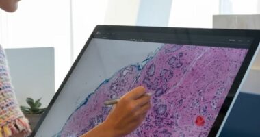 Pritet të dyfishohet në rang global numri i pacientëve me kancer prostate