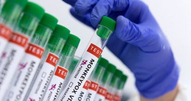 OBSH i hap dritën jeshile testeve të “mpox”