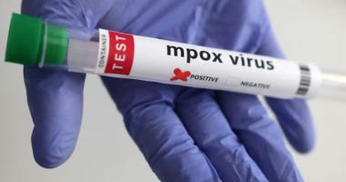 OBSH miraton testin e parë diagnostikues të lisë së majmunit për përdorim emergjent