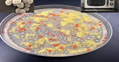 Rezultatet shqetësuese: Ja disa prej mikrobeve që gjenden në furrat me mikrovalë