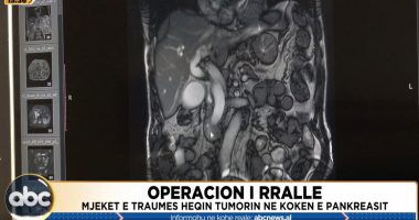 Operacion i rrallë/ Mjekët e Traumës heqin tumorin në kokën e pankreasit