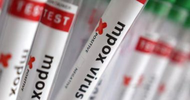 Kinë/ Raportohen pesë raste të reja me variantin e ri të virusit MPOX