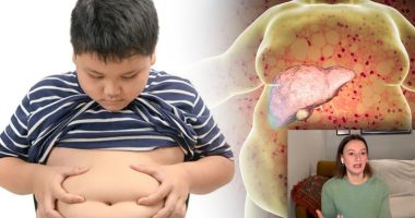 Mëlçia e dhjamosur/ Blerina Bombaj: Në 2024 rastet më të shumta të fëmijëve në 20 vjet të punës sime, shkak kequshqyerja