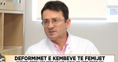 Deformimet e këmbëve te fëmijët/ Mjekët: Rreth 100 bebe në vit lindin me këtë problem
