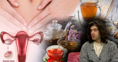 Kistet dhe shëndeti i vezoreve/ Mjeku alternativ tregon shkaqet e shfaqjes së tyre: Ja ushqimet që duhet të konsumoni