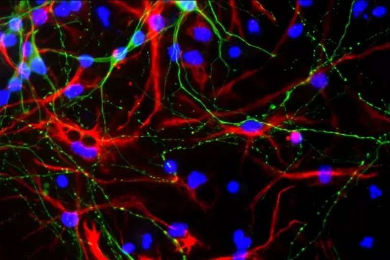 Të dhënat shkencore: Truri mund të vetëriparohet duke prodhuar neurone të reja