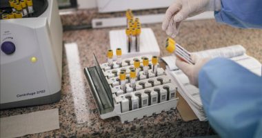 Universiteti i Hong Kongut zhvillon modelin e inteligjencës artificiale për diagnostikimin e kancerit të tiroides