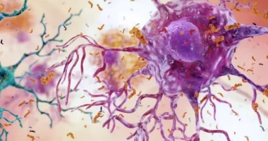 Sheqeri, ‘lojtari’ i ri në lojën kundër Alzheimerit