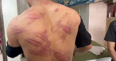 Irani dëbon 1.5 milion afganë: Akuza për spiunazh dhe trajtime çnjerëzore