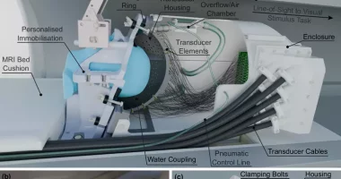 Një helmetë me ultratinguj do të ndalojë dridhjet e Parkinsonit