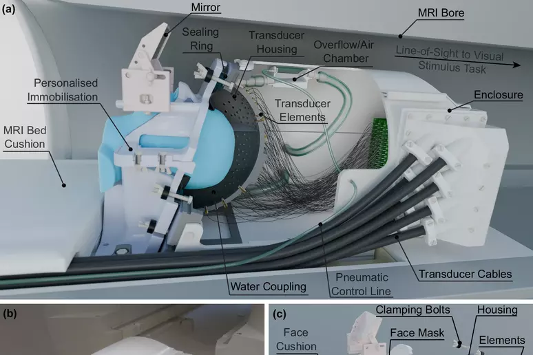 Një helmetë me ultratinguj do të ndalojë dridhjet e Parkinsonit