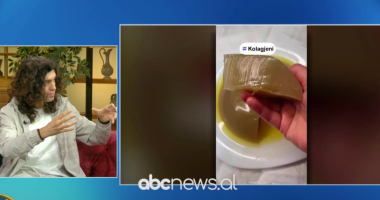 Kolagjeni, zorrët dhe plakja/ E vërteta që duhet të dini sipas Dr. Luciano Bardhi