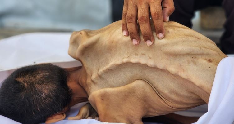 OKB: Nuk ka mbetur shumë kohë për të ndaluar urinë në Gaza