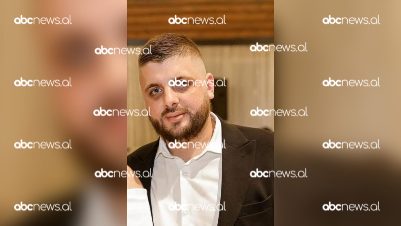 Atentati në Shkodër/ Viktima e dytë, truprojë e anëtarit të grupit të Bajrit