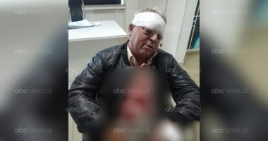 Dhunuan 61-vjeçarin në Vlorë, dy të rinjtë me precedent kriminal/ Zbardhet shkaku i sherrit