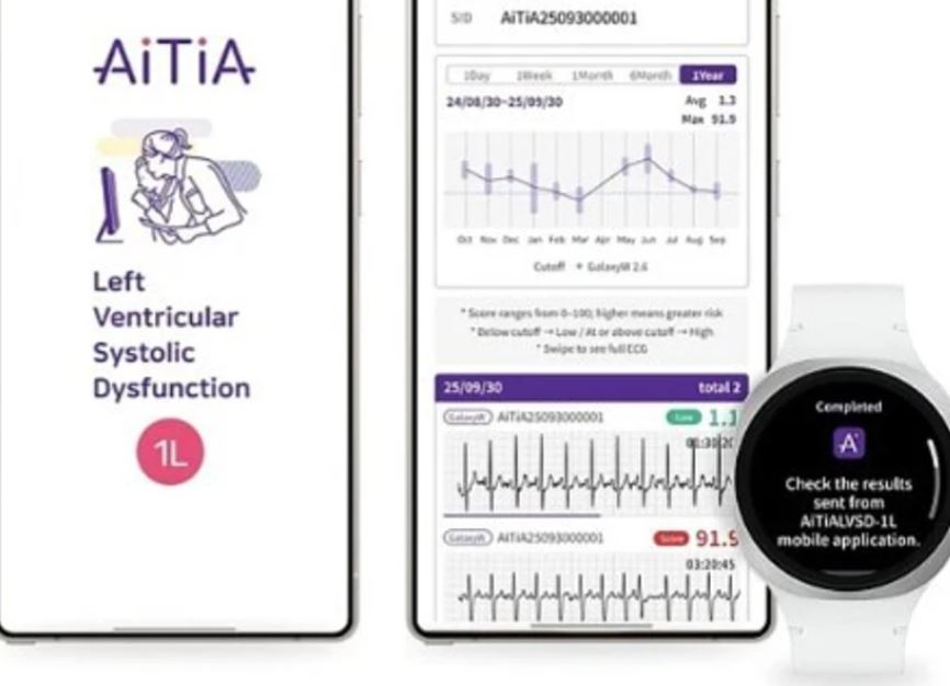 Samsung do të mundësojë zbulimin e problemeve kardiovaskulare nëpërmjet orës inteligjente